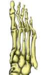 Picture of Foot with Fracture of Second Metatarsal Bone